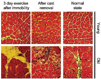 muscle regeneration aging
